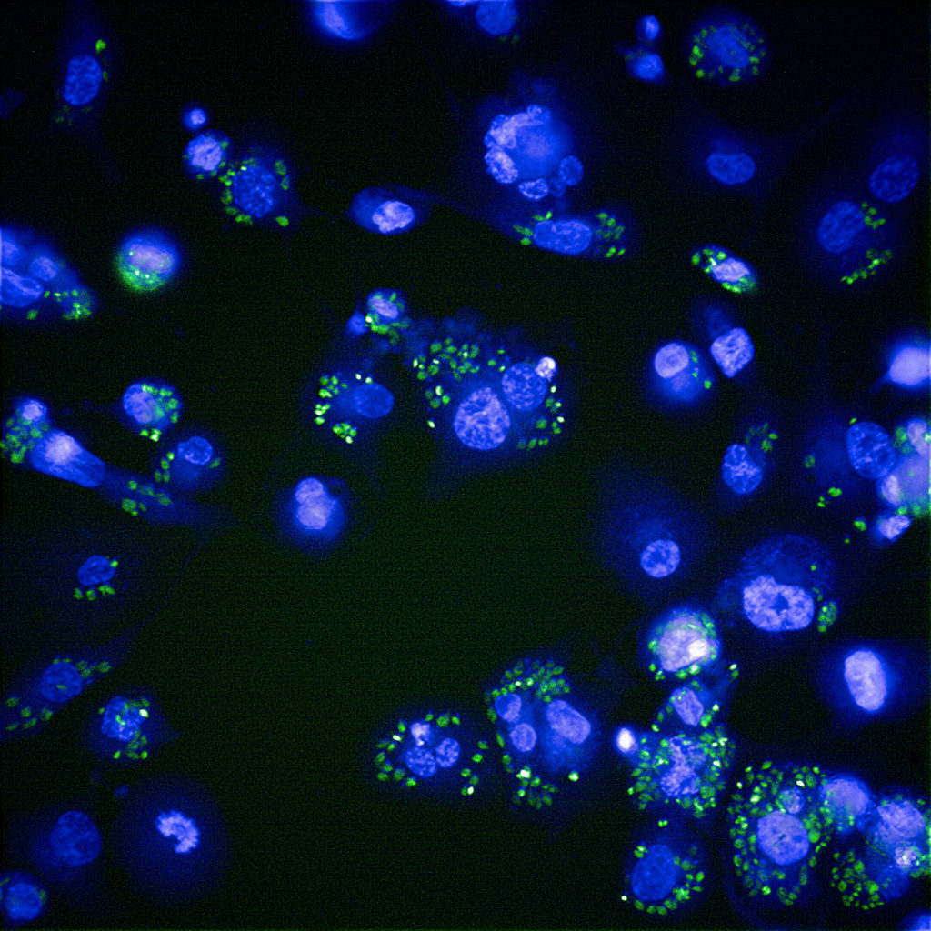 Why did the parasites die? Understanding compound mode of action WCAIR