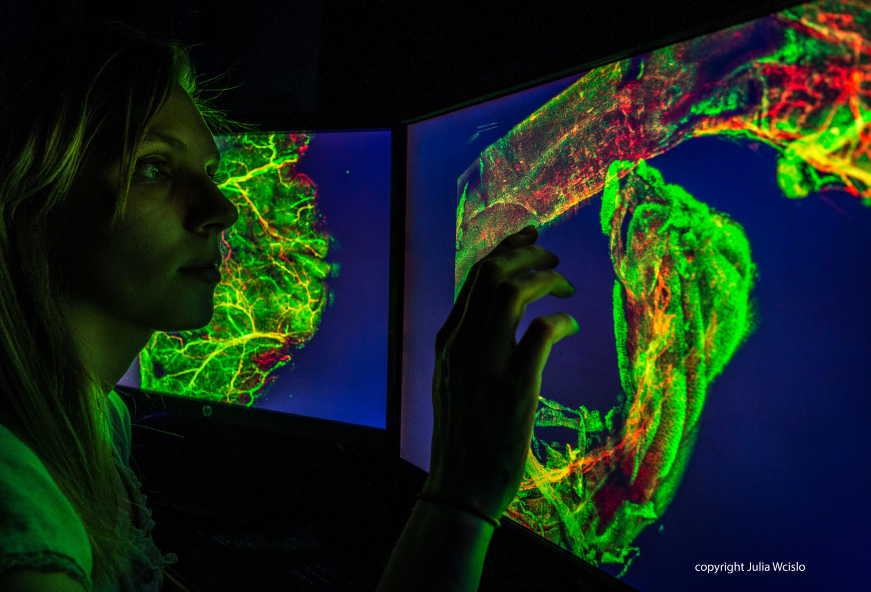 Parasites: Battle for Survival - WCAIR